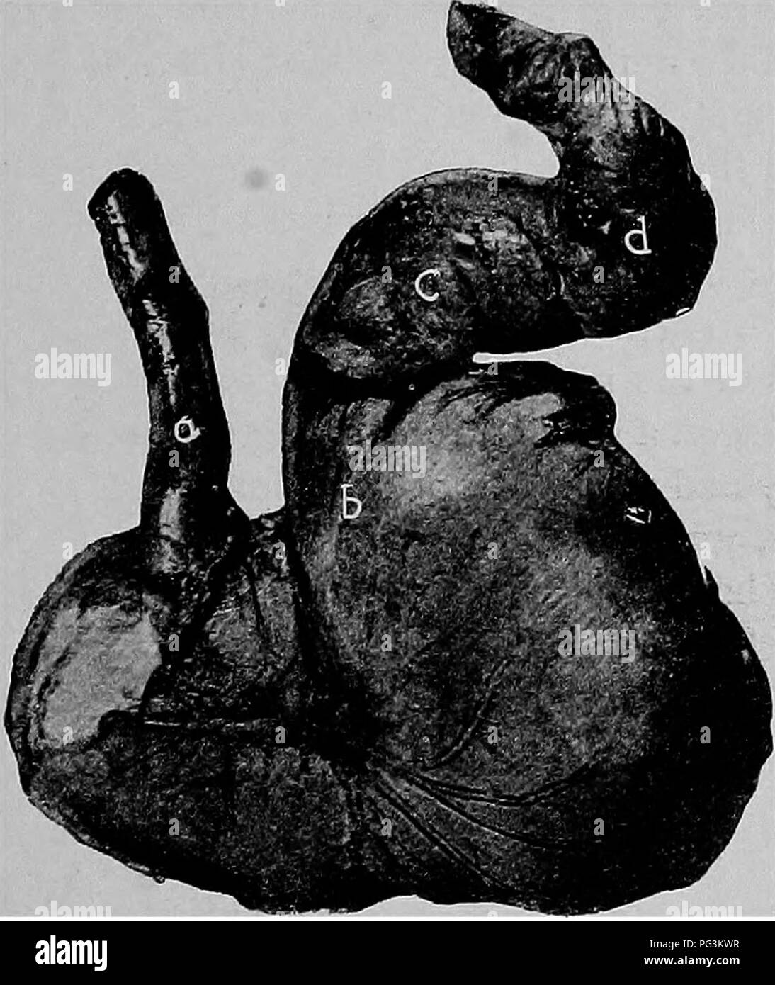 Estomac Distendu Banque D Images Noir Et Blanc Alamy