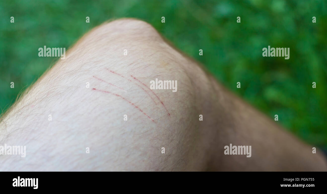 Lesion De La Peau Chat Banque De Photographies Et D Images A Haute Resolution Alamy