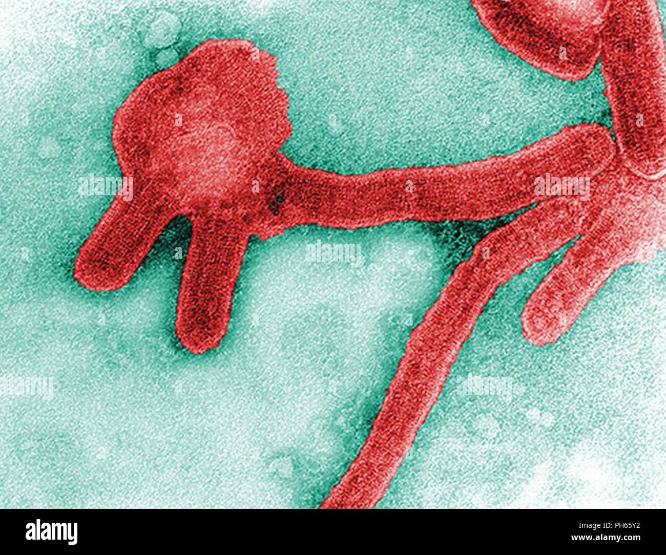 1968 F. A. Murphy ; Cynthia Goldsmith ce vitrail négatif colorisée micrographie électronique à transmission (TEM), capturés par F.A. Murphy en 1968, représente un certain nombre de virus de Marburg, virus qui avaient été cultivées dans un milieu de culture tissulaire des cellules. La fièvre hémorragique de Marburg est une maladie rare, sévère de fièvre hémorragique qui affecte les humains et les primates non humains. Causé par une zoonose génétiquement unique (c'est, d'origine animale) virus à ARN de la famille filovirus, sa reconnaissance a conduit à la création de cette famille de virus. Les quatre espèces de virus Ebola sont les seuls autres membres connus du th Banque D'Images