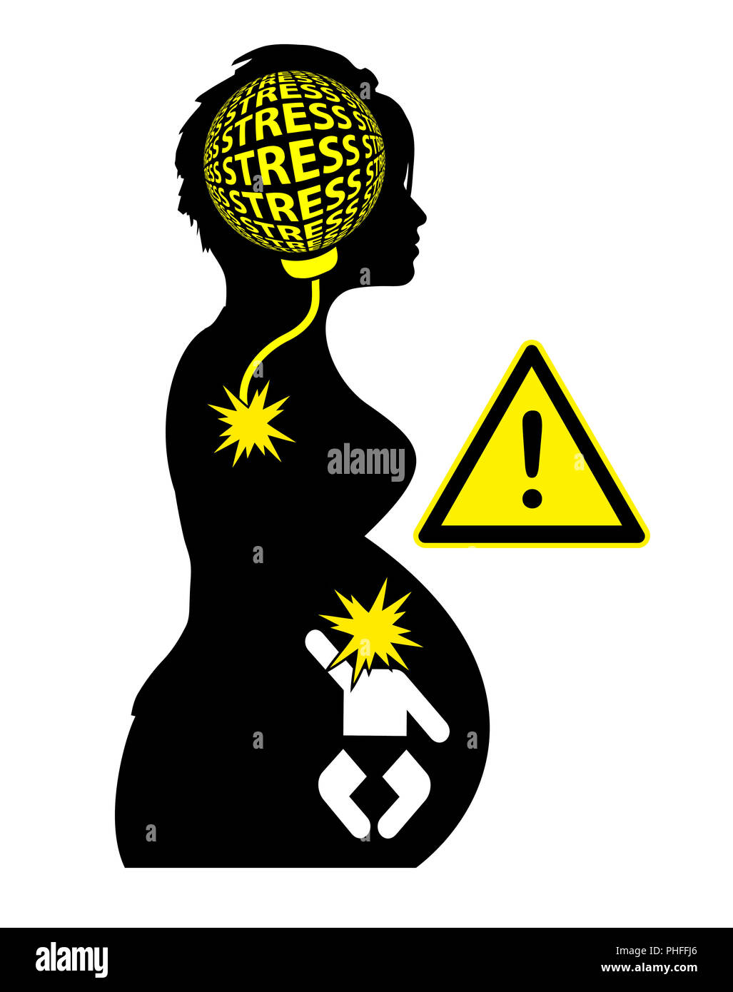 Les soucis de la mère prévoyante affecte le développement du cerveau de l'enfant à naître Banque D'Images