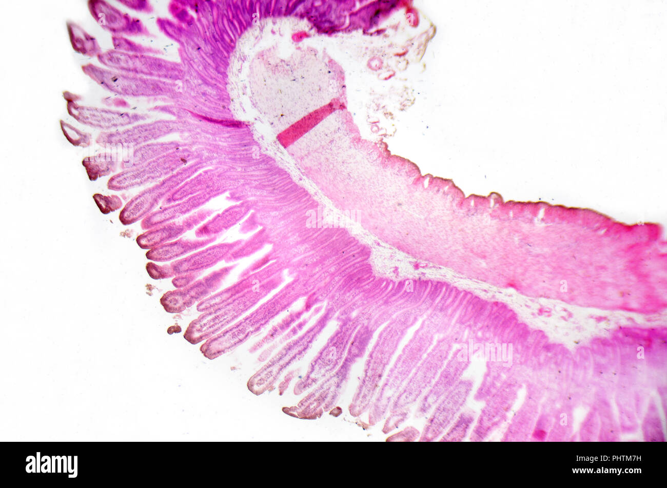 Photographie en microscopie électronique. La section transversale de l'intestin grêle. Banque D'Images