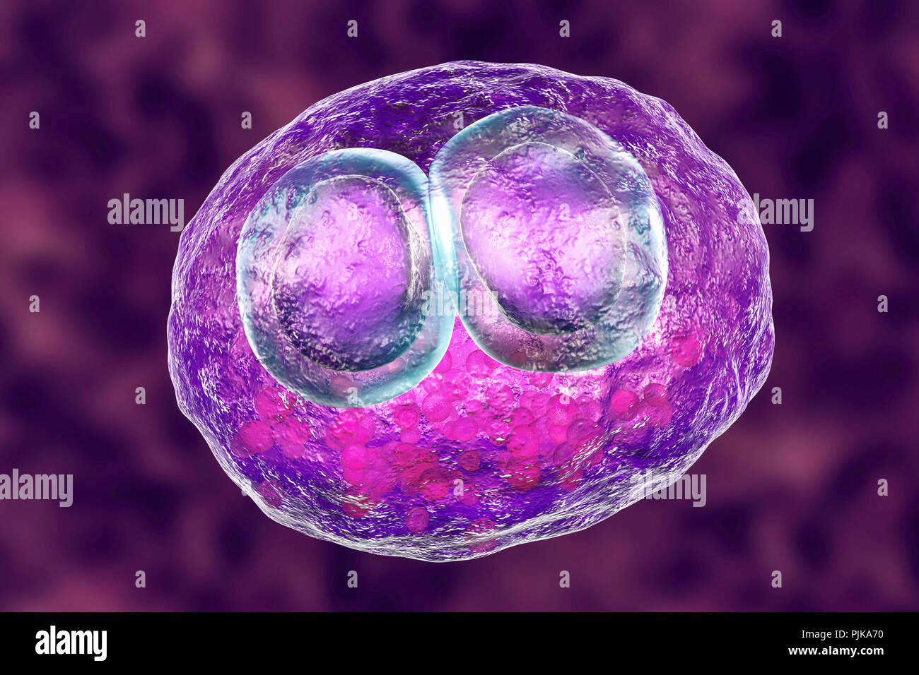 Infection à cytomégalovirus. Illustration d'ordinateur des cellules montrant l'inclusion inclusions cytomégaliques maladie, un symptôme d'infection à cytomégalovirus. Cytomeg Banque D'Images
