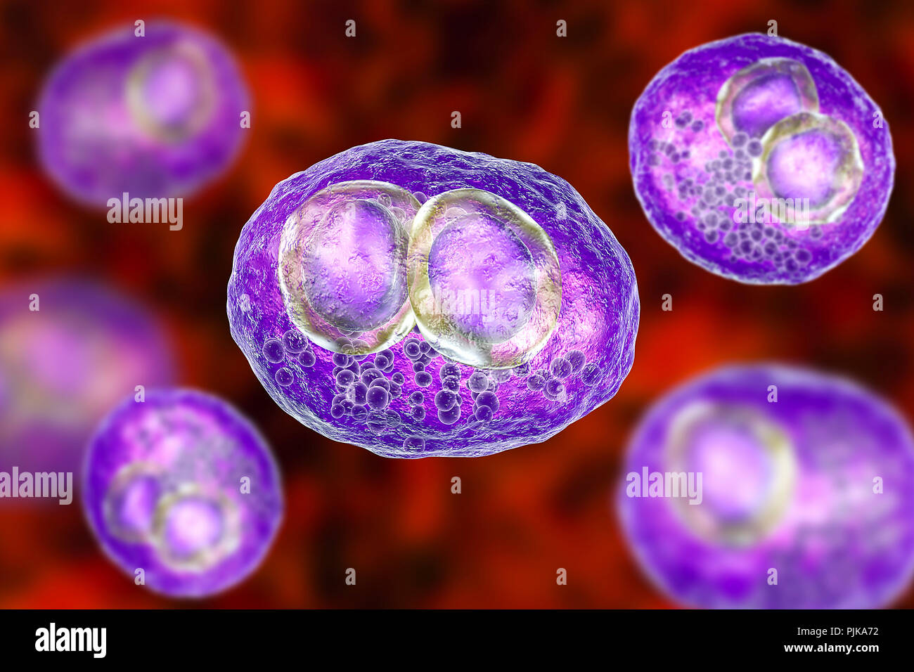 Infection à cytomégalovirus. Illustration d'ordinateur des cellules montrant l'inclusion inclusions cytomégaliques maladie, un symptôme d'infection à cytomégalovirus. Cytomeg Banque D'Images