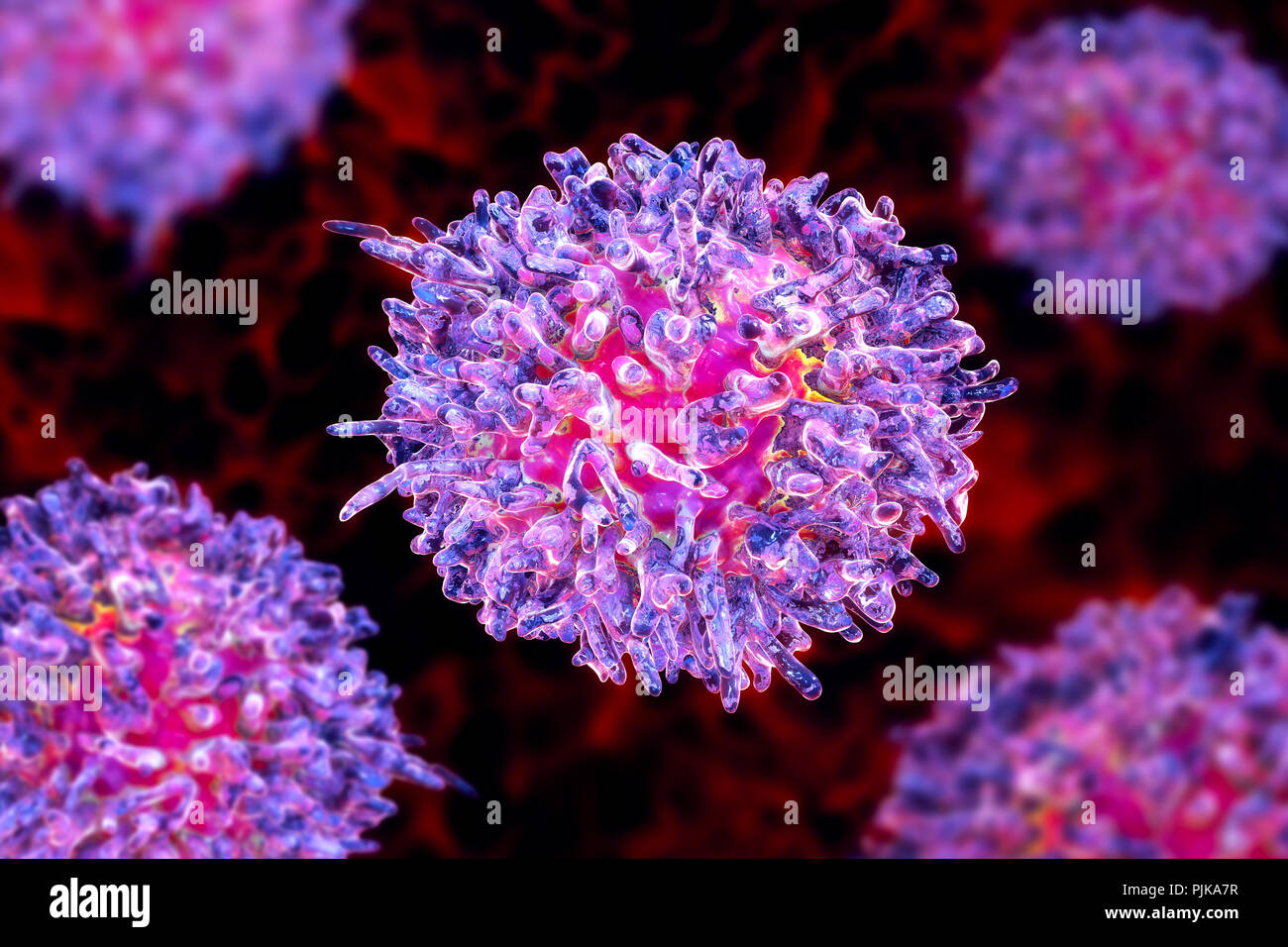 La leucémie à tricholeucocytes. Illustration d'ordinateur d'anomalies des globules blancs (lymphocytes B-) d'un patient atteint de leucémie à tricholeucocytes. Ces cellules montrent Banque D'Images