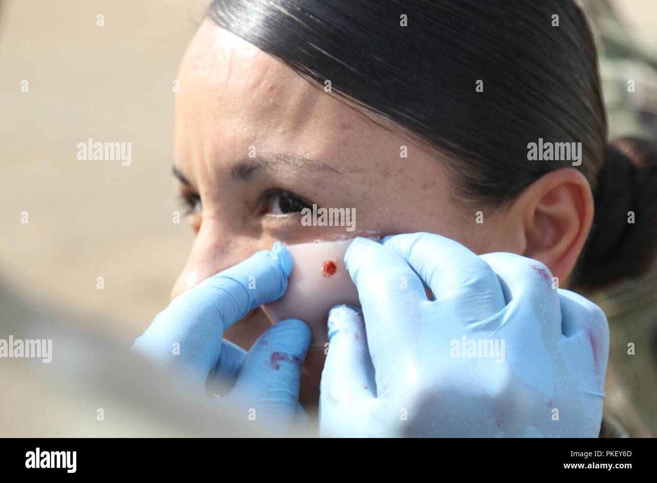 CAMP TAJI, l'Iraq l'Adjudant -Evelyn Ayala, de la 321e brigade de maintien en puissance, est une simulation de blessure mis sur son visage alors qu'une partie d'un événement de formation un grand nombre de blessés, le 26 juillet. Les membres de la 321st, l'Australian and New Zealand Army Corps et rôle 1 de personnel médical à Taji se sont réunis pour tester les procédures opérationnelles standard en place d'une évacuation sanitaire et force de réaction rapide, temps de réponse en cas d'une urgence réelle. ( Banque D'Images