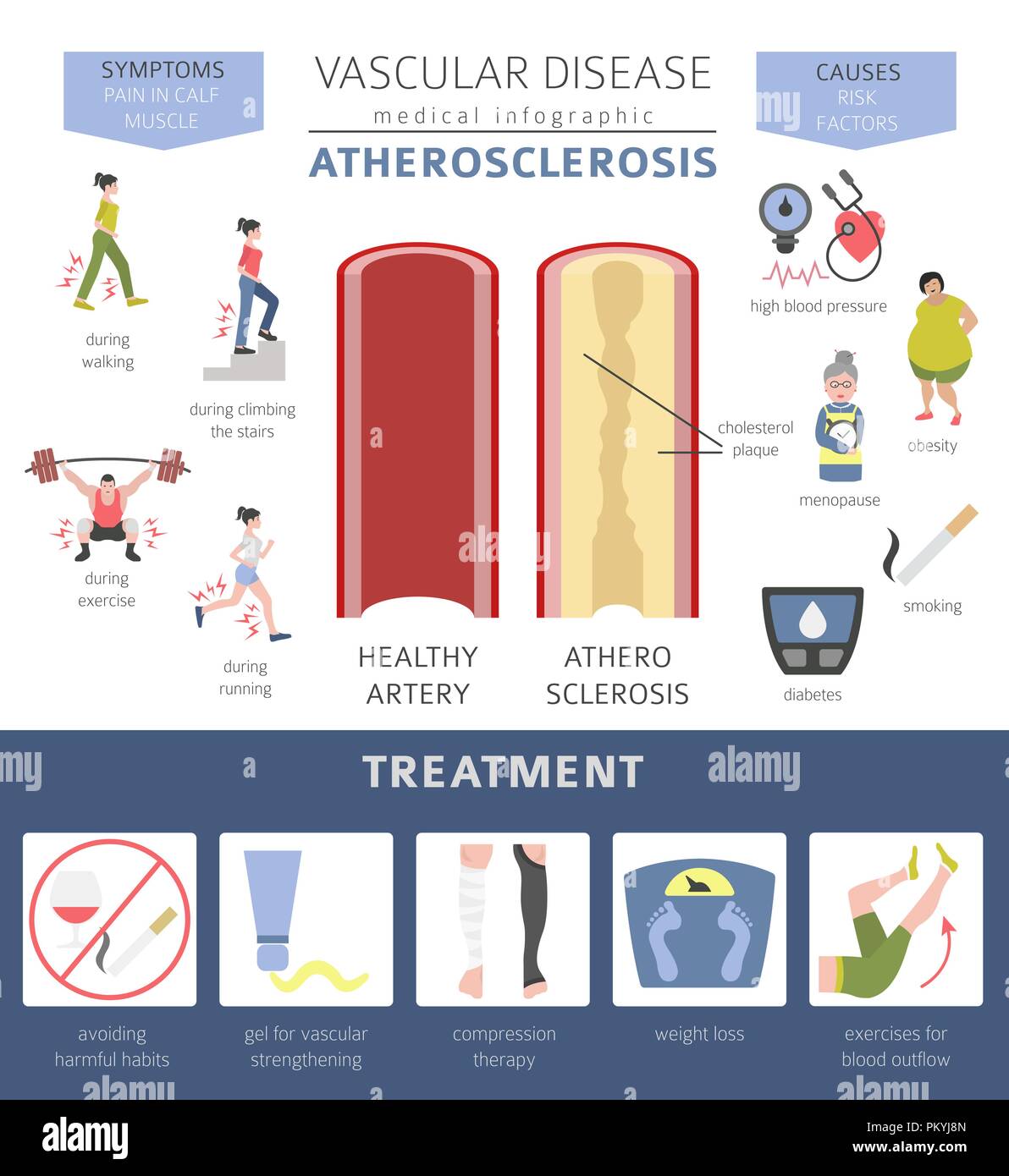 Les maladies vasculaires. L'athérosclérose symptômes, traitement icon set. Conception infographique médical. Vector illustration Illustration de Vecteur