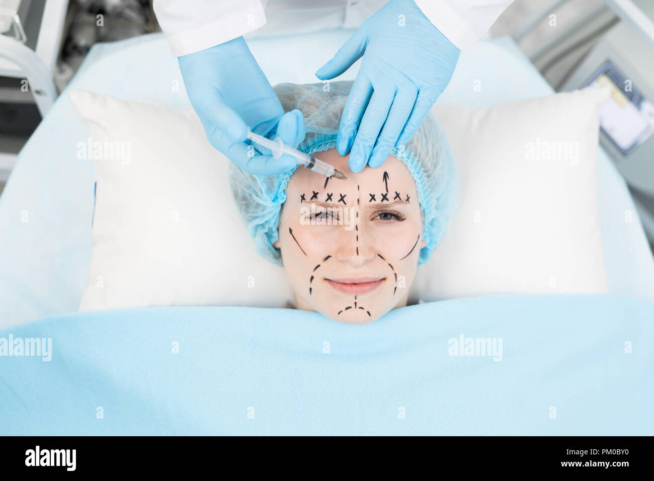 Jeune femme ayant le rajeunissement d'injection sur le front avec les zones marquées sur son visage Banque D'Images