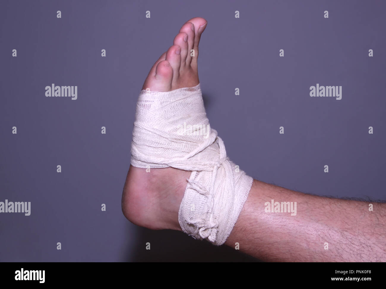 Enveloppé l'entorse de la cheville Banque D'Images