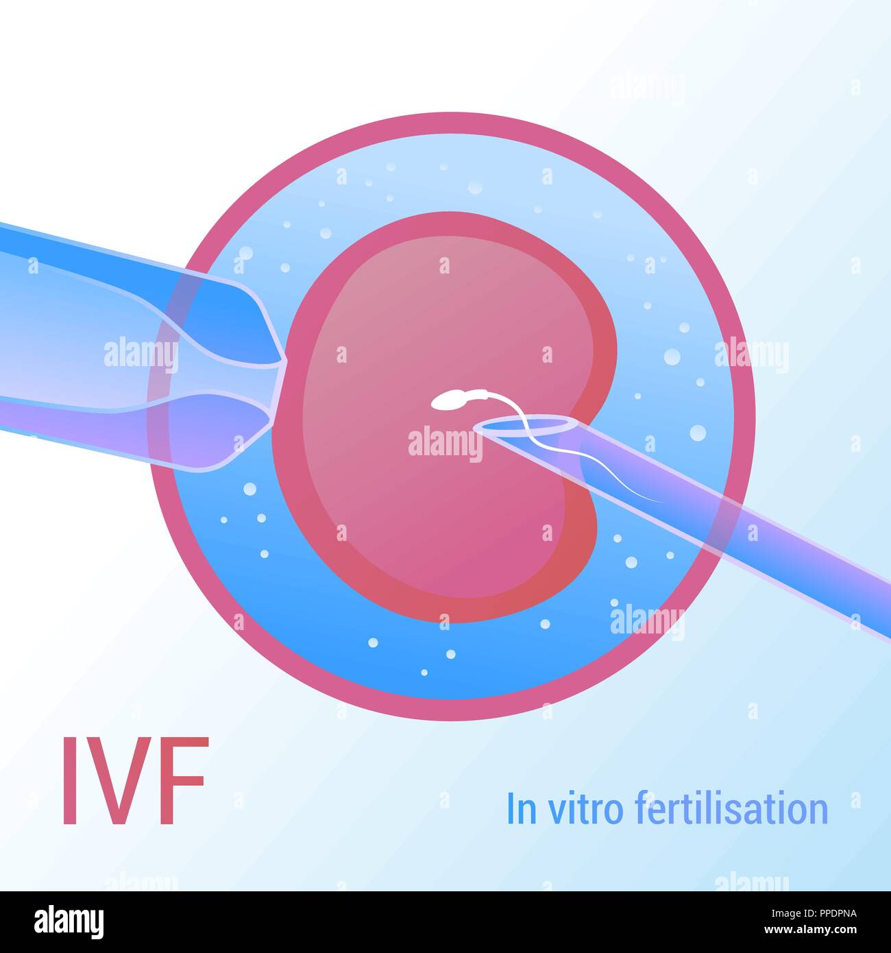 La FIV. L'insémination artificielle. Vector design 3D réaliste Illustration de Vecteur