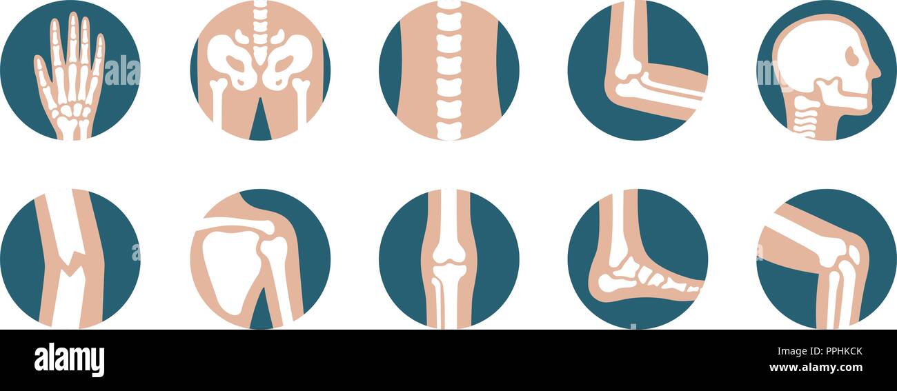 Ensemble d'articulations et les os. Genou jambe, vecteur, du bassin, de l'omoplate, du crâne, du coude, du pied et de la main d'icônes. Squelette d'orthopédie et de symboles sur fond blanc Illustration de Vecteur