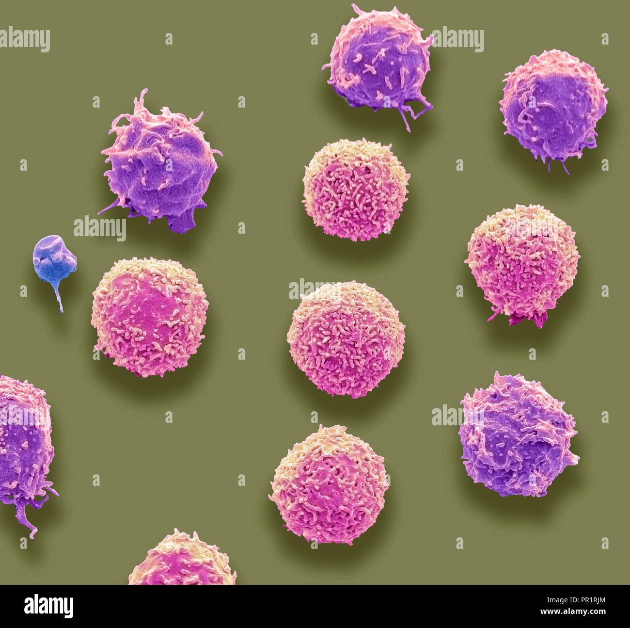 Les cellules de sang blanches et une numération plaquettaire. Couleur de l'analyse des électrons Microphotographie (SEM) de globules blancs et de plaquettes d'un seul (bleu). Les plaquettes sont des fragments de cellules de sang blanches qui, dans des circonstances normales, sont de petite taille et de forme biconcave. Cependant, s'il y a une rupture de la surface d'un vaisseau sanguin, les plaquettes sont en contact avec des molécules qu'elles ne sont pas utilisées pour devenir et activé. Agrandissement : x3000 lors de l'impression à 10 centimètres de large. Banque D'Images