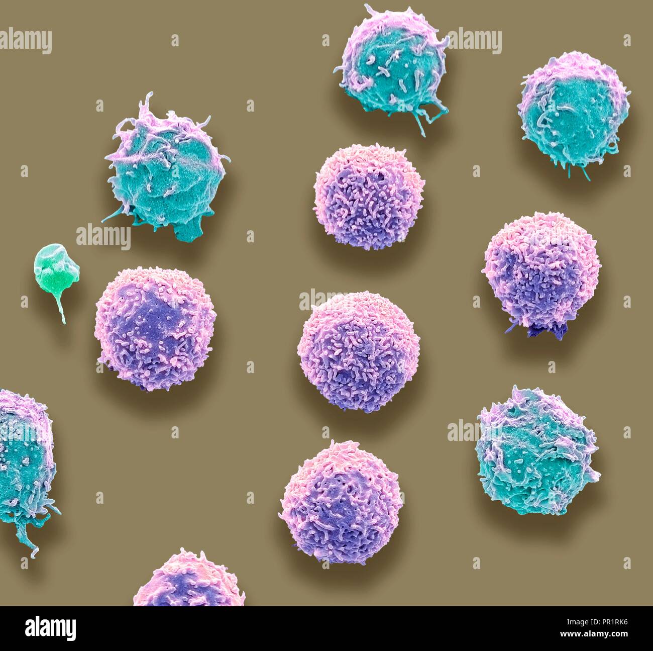 Les cellules de sang blanches et une numération plaquettaire. Couleur de l'analyse des électrons Microphotographie (SEM) de globules blancs et de plaquettes d'un seul (bleu). Les plaquettes sont des fragments de cellules de sang blanches qui, dans des circonstances normales, sont de petite taille et de forme biconcave. Cependant, s'il y a une rupture de la surface d'un vaisseau sanguin, les plaquettes sont en contact avec des molécules qu'elles ne sont pas utilisées pour devenir et activé. Agrandissement : x3000 lors de l'impression à 10 centimètres de large. Banque D'Images