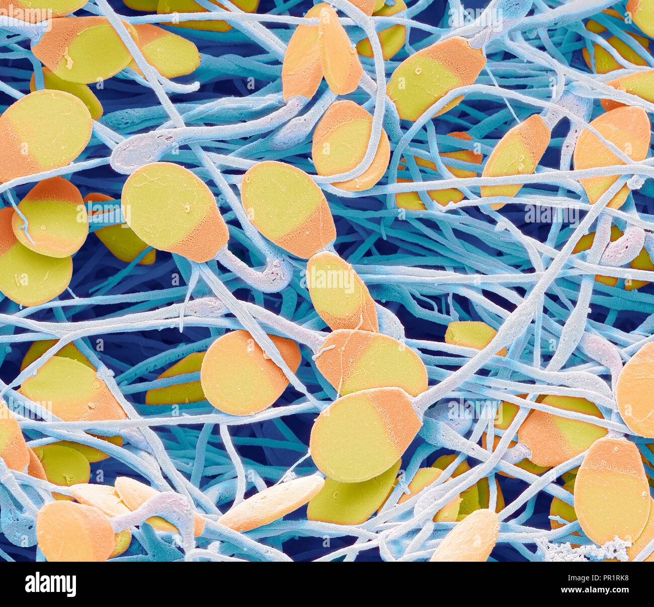 Sperme de porc. Couleur de l'analyse des électrons Microphotographie (SEM) de sperme de porc immature dans l'épididyme. Ce spermatozoïdes immatures se caractérise par une petite quantité de cytoplasme résiduel contenues au-dessous de la tête. L'épididyme est un 7 mètres de long tube spiralé qui se cache derrière chaque testicule, recevant le sperme d'eux. Le spermatozoïde mature comme ils passent lentement à travers ce tube. Agrandissement : x4000 lors de l'impression à 10 centimètres de large. Banque D'Images