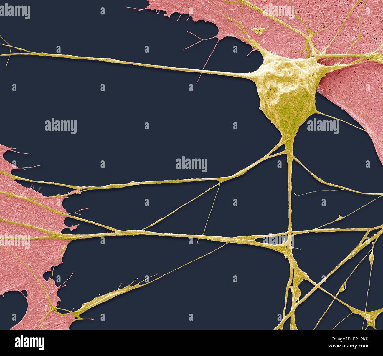 Dérivés de cellules souches de neurone de moteur. Couleur de l'analyse des électrons Microphotographie (SEM) d'une cellule nerveuse (neurone) qui a été calculée à partir de cellules souches pluripotentes embryonnaires (ES). Les cellules souches pluripotentes sont capables de se différencier en n'importe lequel des 200 types de cellules du corps humain. Le type de cellule ils mûrissent en dépend de la signaux biochimiques reçu par la cellules immatures. Cette capacité fait d'eux une source potentielle de cellules pour réparer des tissus endommagés dans des maladies telles que la maladie de Parkinson et le diabète insulino-dépendant. Agrandissement : x 1500 lors de l'impression 10 centimètres de large. Banque D'Images