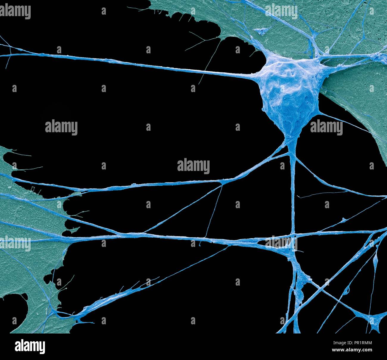 Dérivés de cellules souches de neurone de moteur. Couleur de l'analyse des électrons Microphotographie (SEM) d'une cellule nerveuse (neurone) qui a été calculée à partir de cellules souches pluripotentes embryonnaires (ES). Les cellules souches pluripotentes sont capables de se différencier en n'importe lequel des 200 types de cellules du corps humain. Le type de cellule ils mûrissent en dépend de la signaux biochimiques reçu par la cellules immatures. Cette capacité fait d'eux une source potentielle de cellules pour réparer des tissus endommagés dans des maladies telles que la maladie de Parkinson et le diabète insulino-dépendant. Agrandissement : x1500 lors de l'impression 10 centimètres de large. Banque D'Images