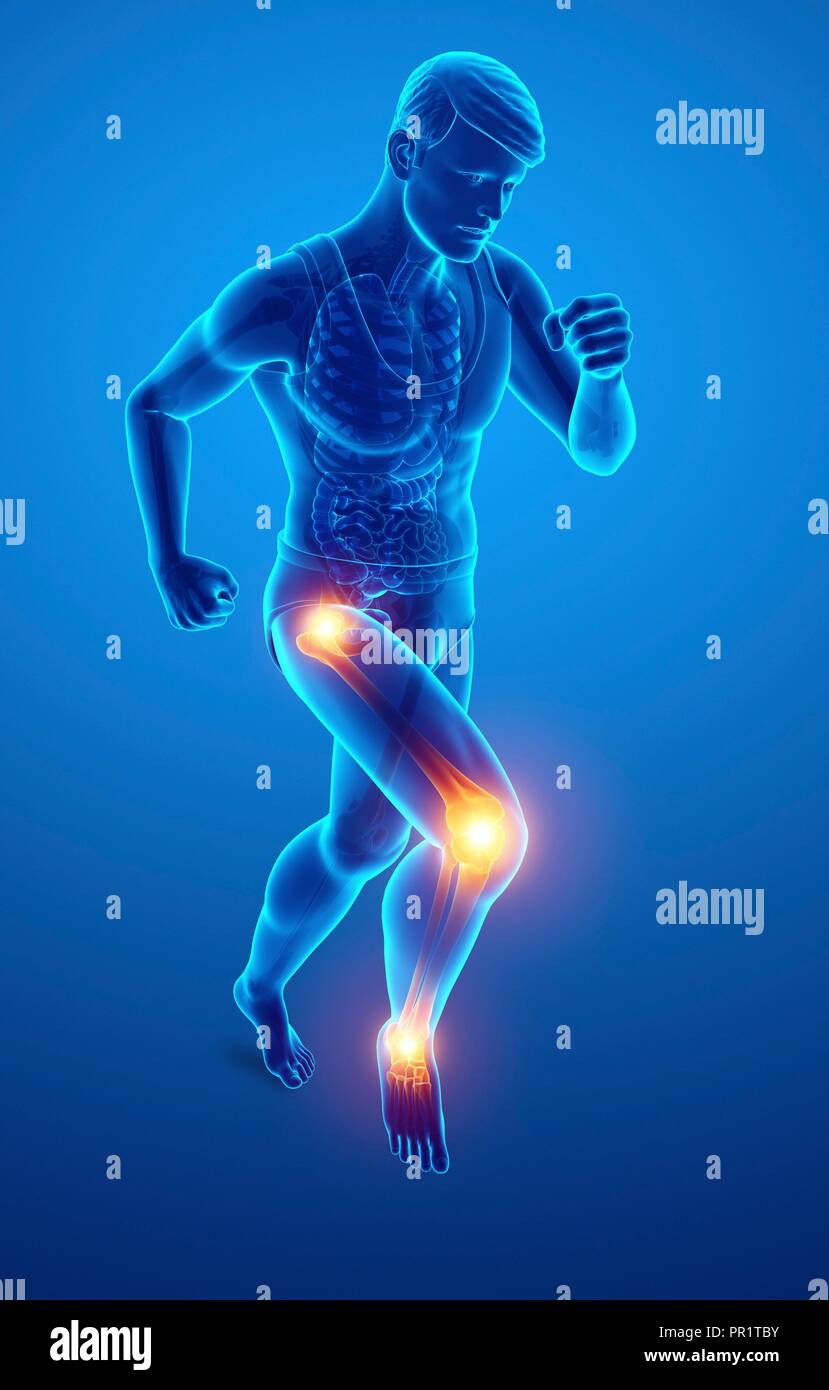 Homme avec une douleur au genou, l'illustration de l'ordinateur. Banque D'Images