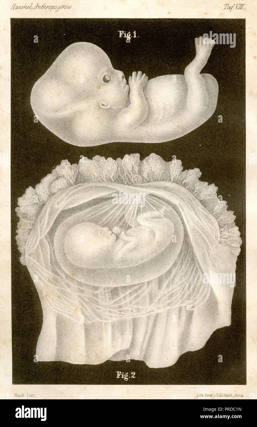Foetus humain dans l'utérus, Ernst Haeckel 1877 1877 Banque D'Images