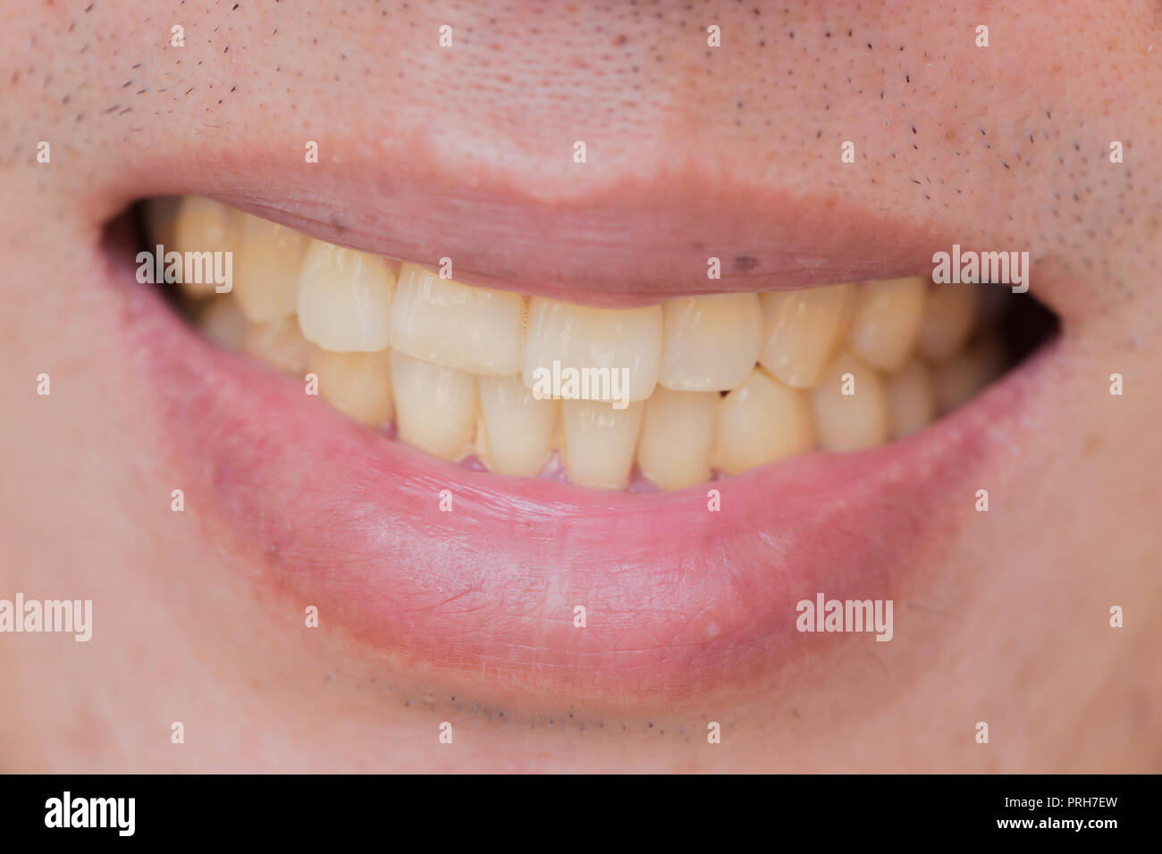 Les dents jaunes à l'homme à partir de café et de fumée Banque D'Images