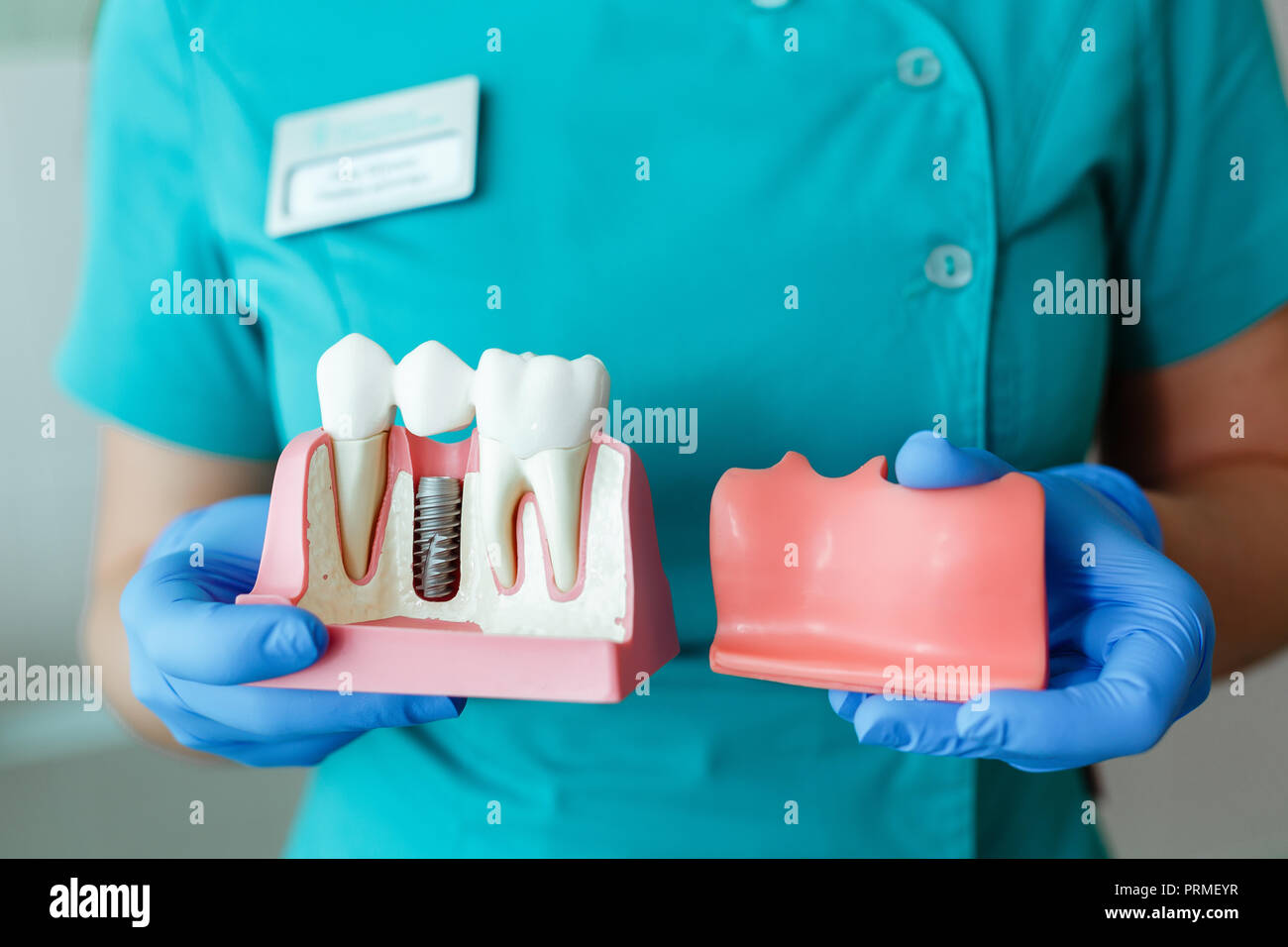 Mains de la dentiste titulaire d'un modèle d'expérimentation de la dent avec un implant Banque D'Images