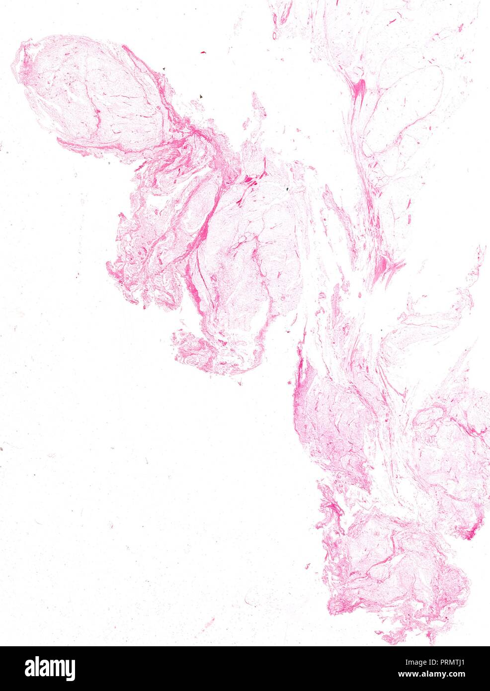 Des tranches de tissu humain, close-up des organes intérieurs. Banque D'Images