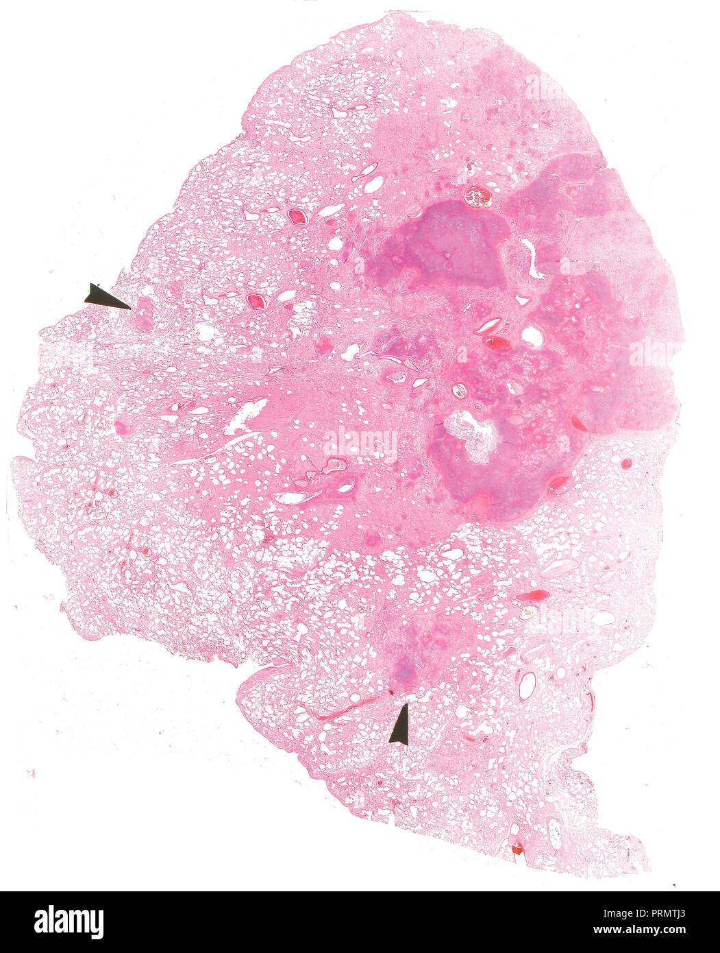 Des tranches de tissu humain, close-up des organes intérieurs. Banque D'Images