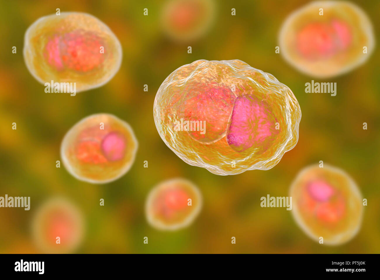 Chlamydia trachomatis bactéries. Illustration montrant une inclusion de l'ordinateur composé d'un groupe de corps réticulés chlamydia intracellulaires (stade, multipliant les petites sphères orange) près du noyau (rose) d'une cellule. Chlamydia trachomatis provoque une infection transmise sexuellement qui peut passer inaperçue provoquant l'infertilité. Il provoque aussi la maladie de l'oeil le trachome, qui peut conduire à la cécité. Banque D'Images