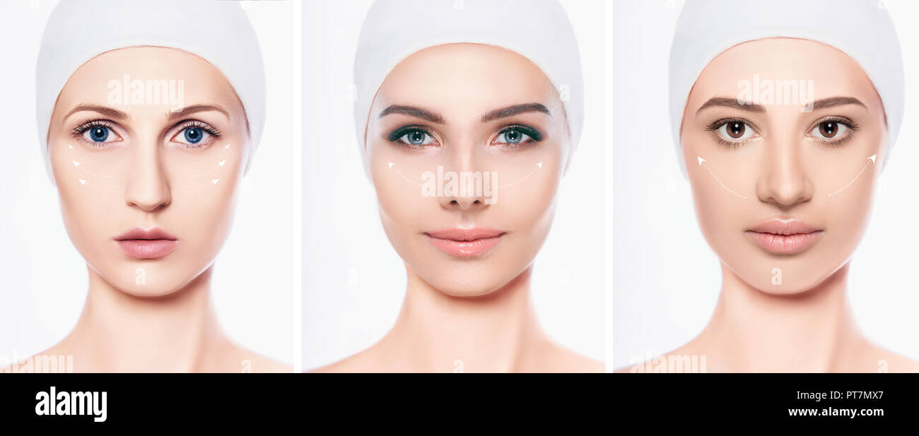 Beau jeu de visage de femme avec des flèches de levage sur le visage , et les procédures de rajeunissement de la peau lifting Banque D'Images