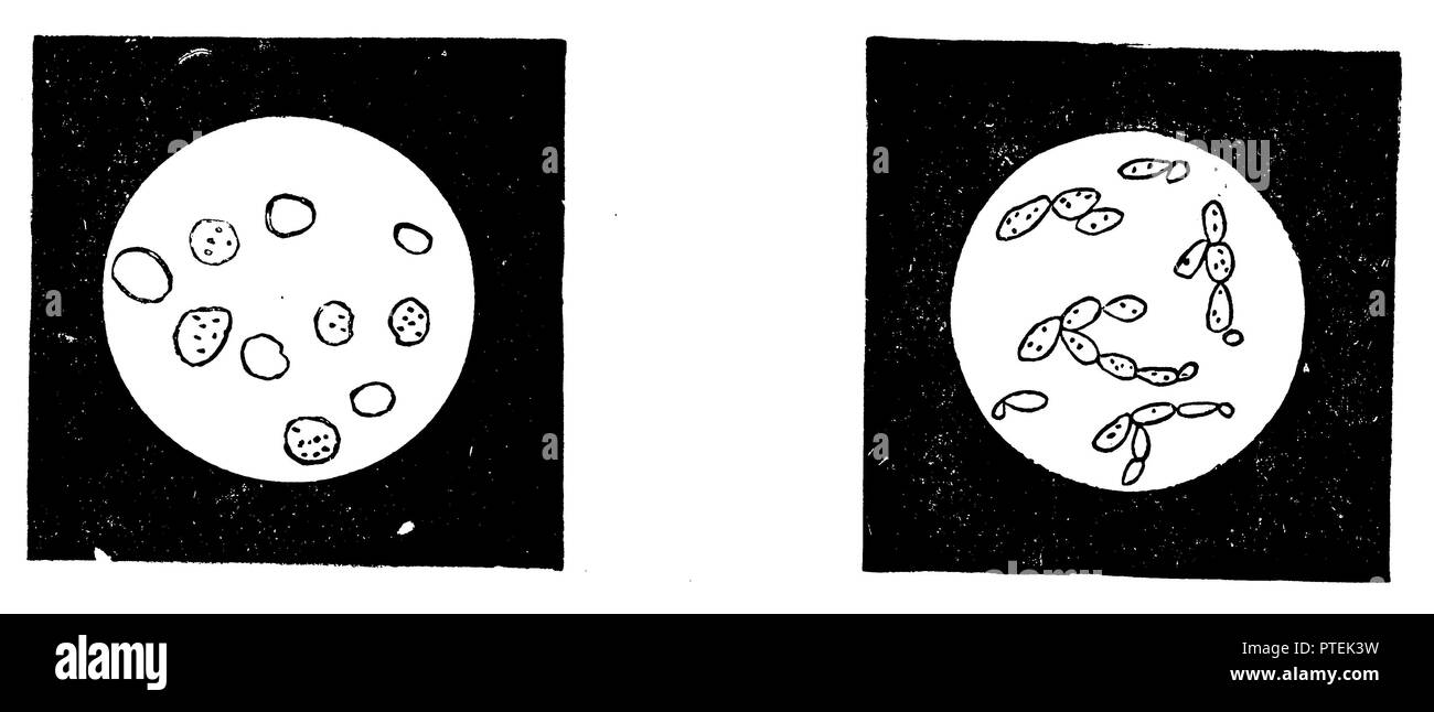 Levure supérieure (à gauche), levure (droite), anonym 1900 Banque D'Images