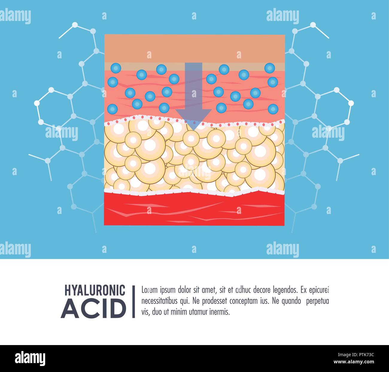 L'acide hyaluronique injection de remplissage infographie Illustration de Vecteur