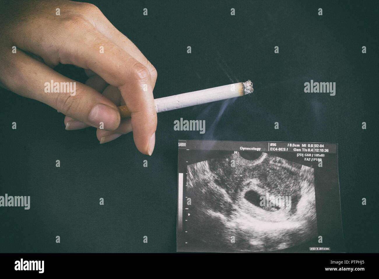 A woman's hand est titulaire d'une cigarette dans le contexte d'une photo de l'uzi de la grossesse, la grossesse et le tabagisme, la gestation Banque D'Images