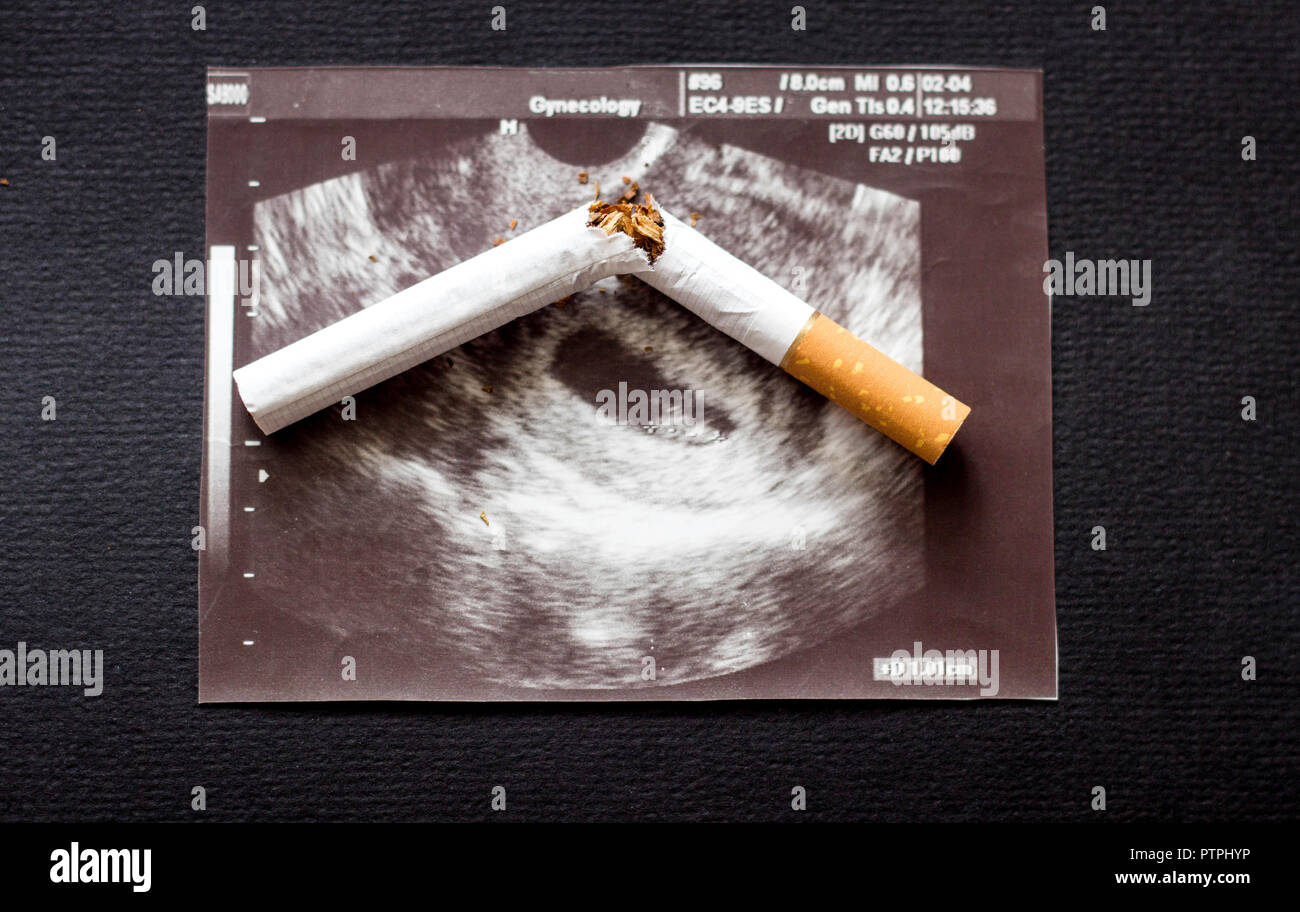 Cigarette cassée sur une photo de grossesse uzi, Tabagisme et grossesse, grossesse et cigarette Banque D'Images