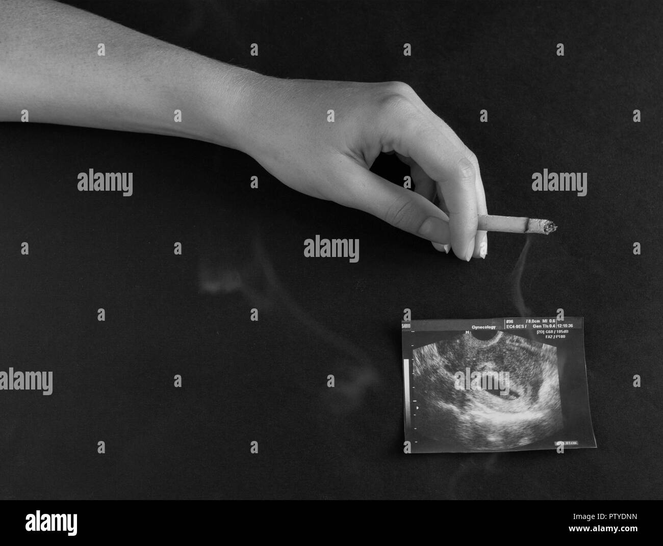 A woman's hand est titulaire d'une cigarette dans le contexte d'une photo de l'uzi de la grossesse, la grossesse et le tabagisme, la gestation Banque D'Images