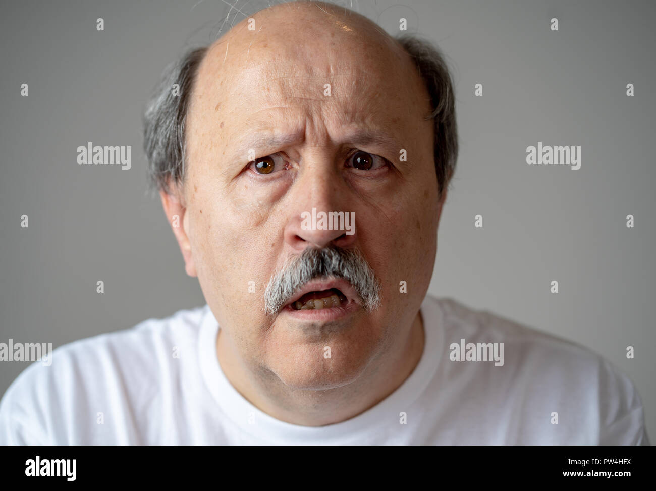 Close up portrait of senior man looking confus et perdu souffrant de démence, perte de mémoire ou de la maladie d en santé mentale chez les adultes plus âgés et plus tard Banque D'Images