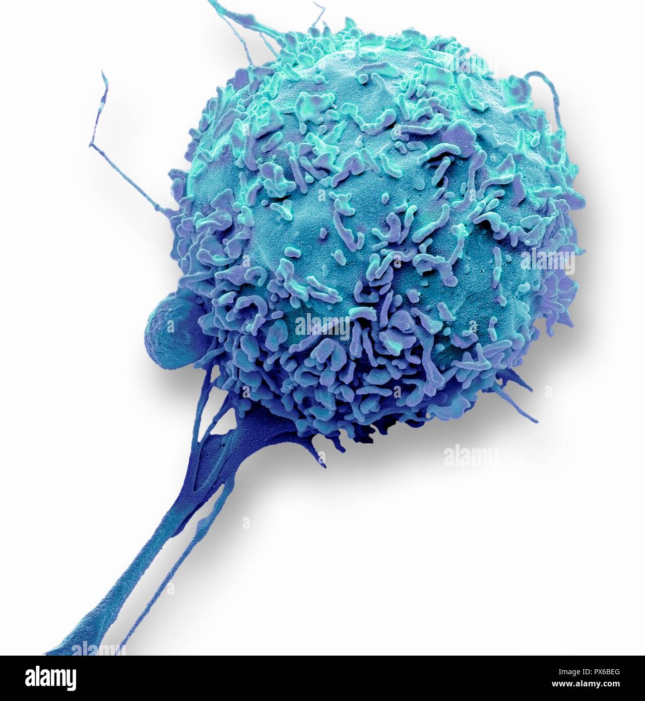 Macrophage. Couleur de l'analyse des électrons Microphotographie (SEM) d'un macrophage globules blancs. Les macrophages sont des cellules du système immunitaire de l'organisme. Ils sont trouvés dans les tissus plutôt que dans le sang circulant. Les macrophages reconnaissent les particules étrangères, y compris les bactéries, le pollen et la poussière, et l'engloutir (phagocytose) et de les digérer. Agrandissement : x4000 lors de l'impression à 10 centimètres de large. Banque D'Images