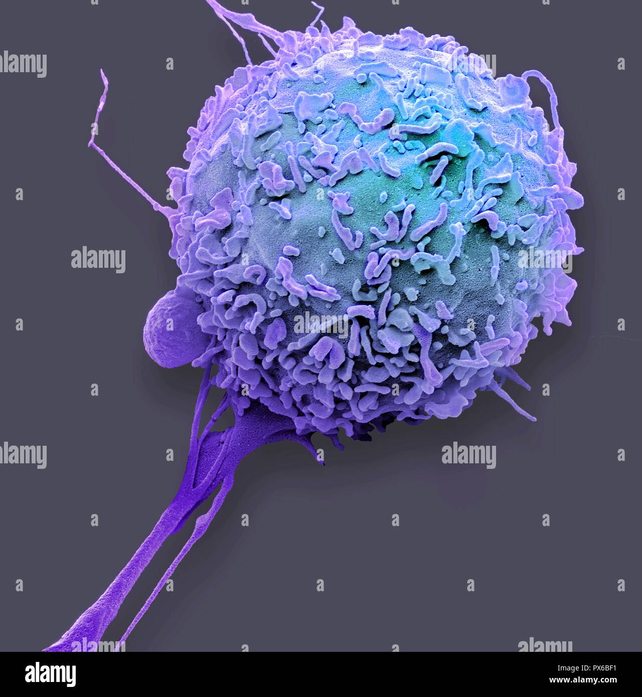 Macrophage. Couleur de l'analyse des électrons Microphotographie (SEM) d'un macrophage globules blancs. Les macrophages sont des cellules du système immunitaire de l'organisme. Ils sont trouvés dans les tissus plutôt que dans le sang circulant. Les macrophages reconnaissent les particules étrangères, y compris les bactéries, le pollen et la poussière, et l'engloutir (phagocytose) et de les digérer. Agrandissement : x4000 lors de l'impression à 10 centimètres de large. Banque D'Images