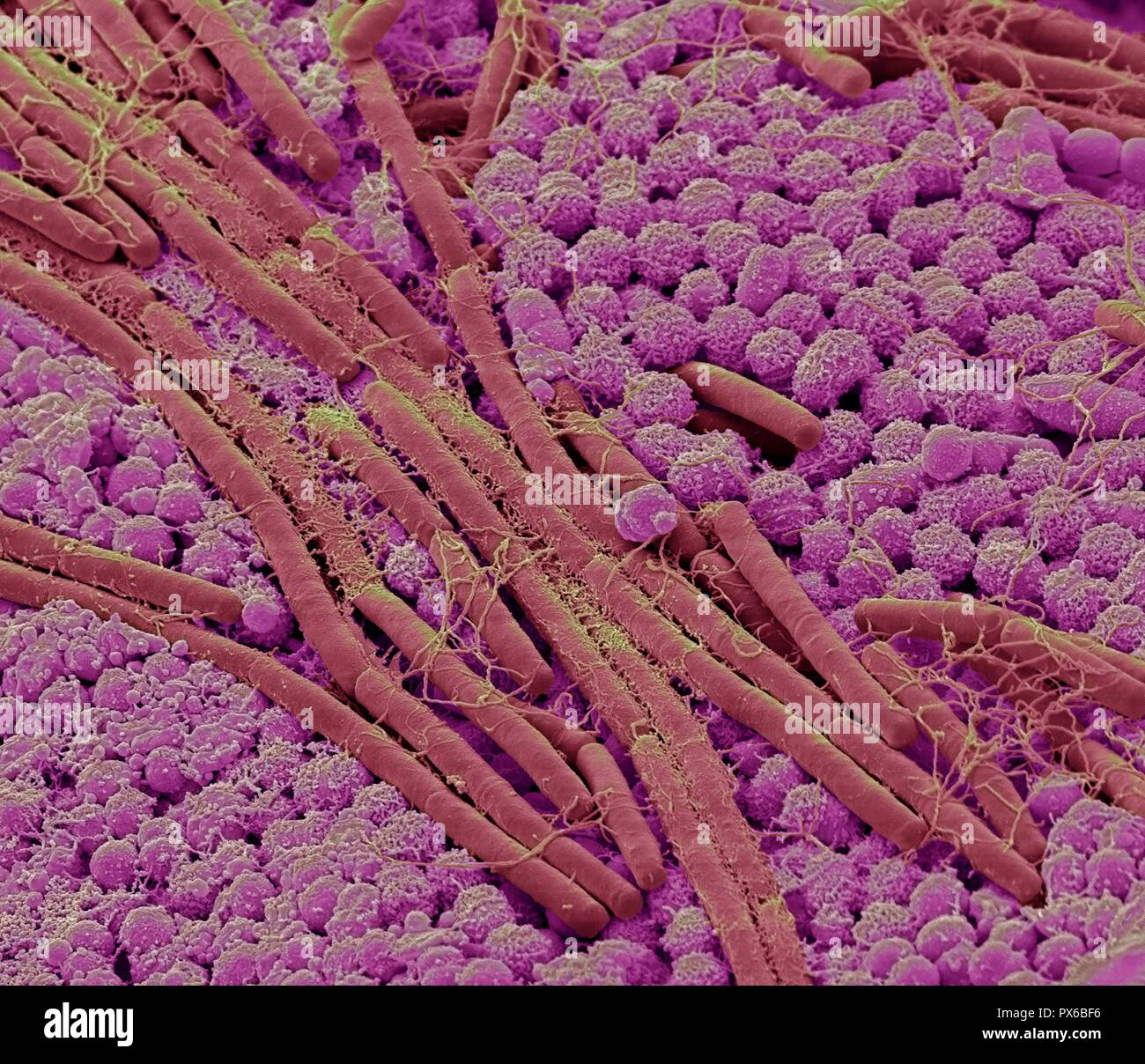 Les bactéries de la langue. Couleur de l'analyse des électrons Microphotographie (SEM) de bactéries sur la surface d'une langue humaine. Un grand nombre de bactéries peuvent former une couche visible sur la surface de la langue. La bouche contient un grand nombre de bactéries, dont la plupart sont inoffensives ou même utiles. Cependant, certaines bactéries peuvent causer des infections de la gorge ou entraîner la formation de dépôts de plaque sur les dents, ce qui peut mener à la décomposition. Agrandissement : x10000 à 10cm de large.les bactéries de la langue Banque D'Images