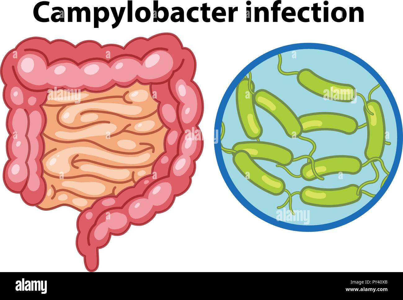 Les cellules de l'infection par campylobacteri grossie illustration Illustration de Vecteur