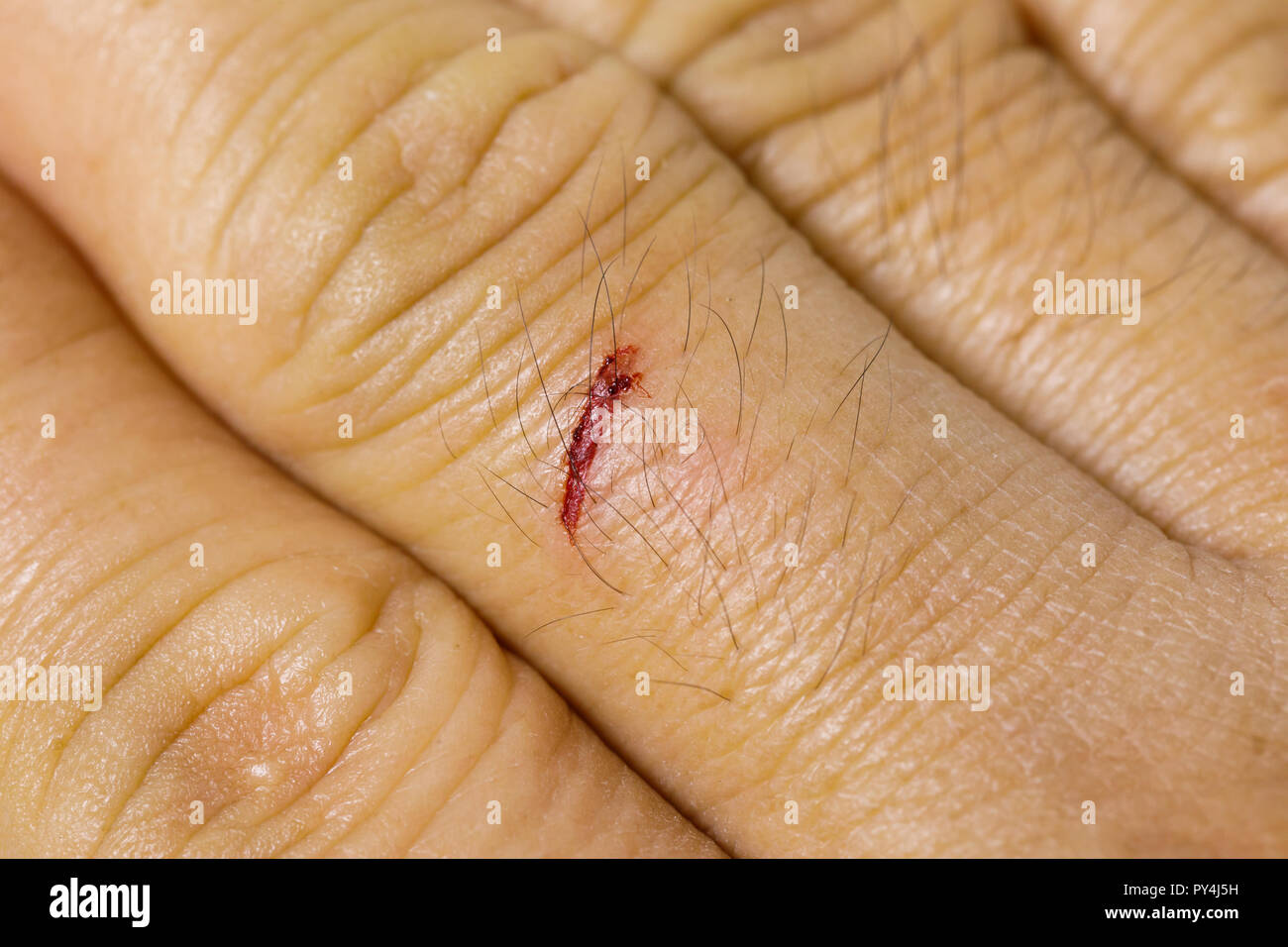 Close up fresh petite plaie sur le doigt du milieu Banque D'Images