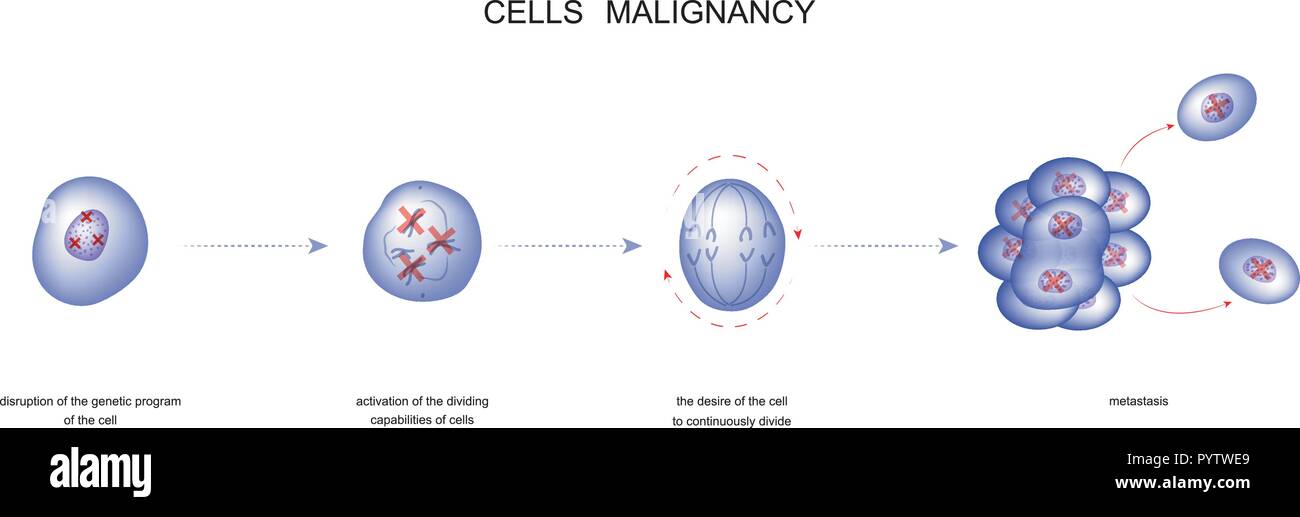 Vector illustration d'un processus de cellules de tumeur maligne Illustration de Vecteur