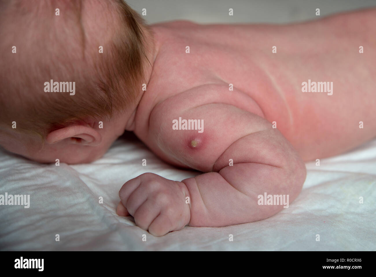 Vaccin g Banque D Image Et Photos Alamy
