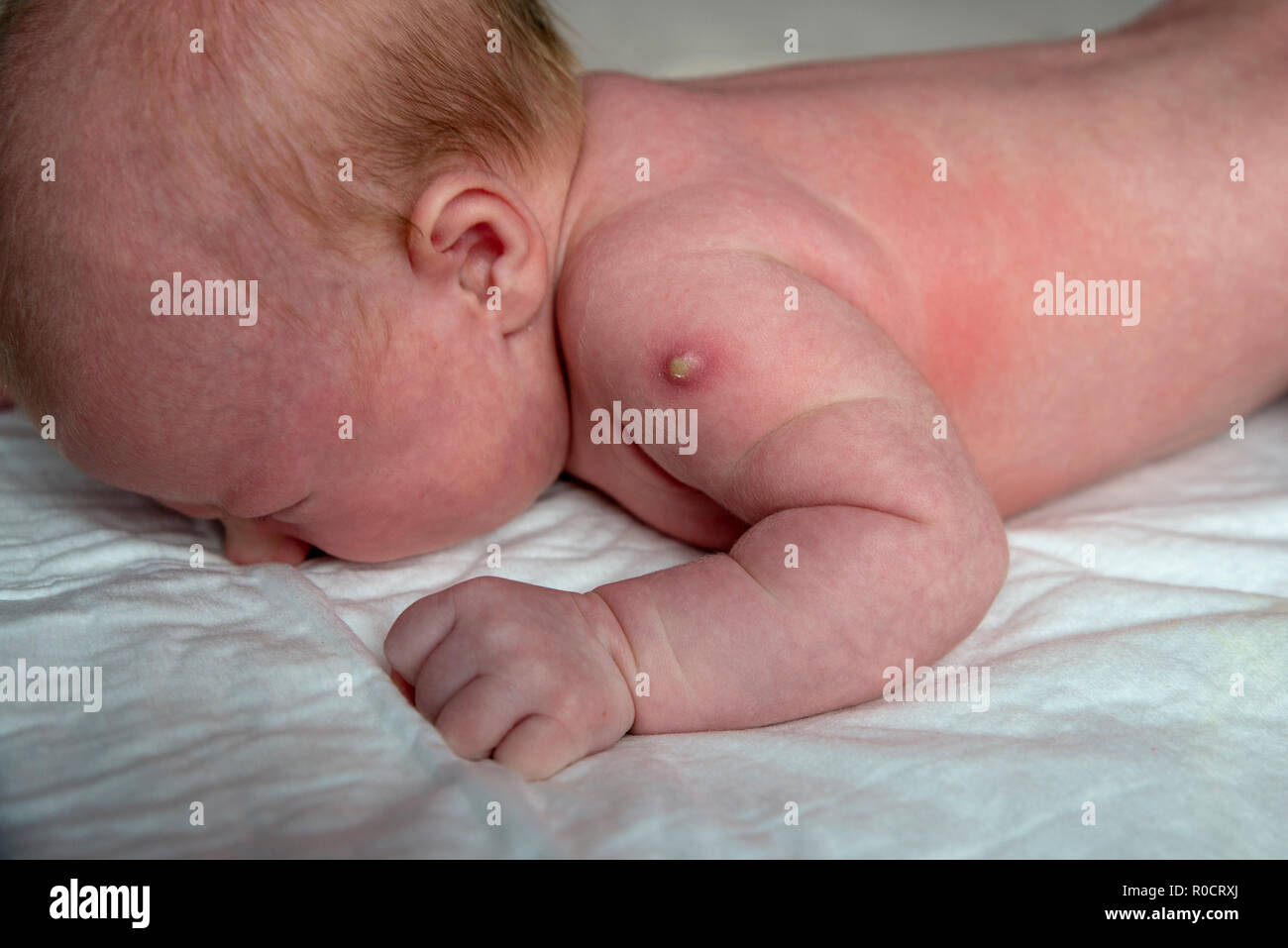 Vaccin g Banque D Image Et Photos Alamy