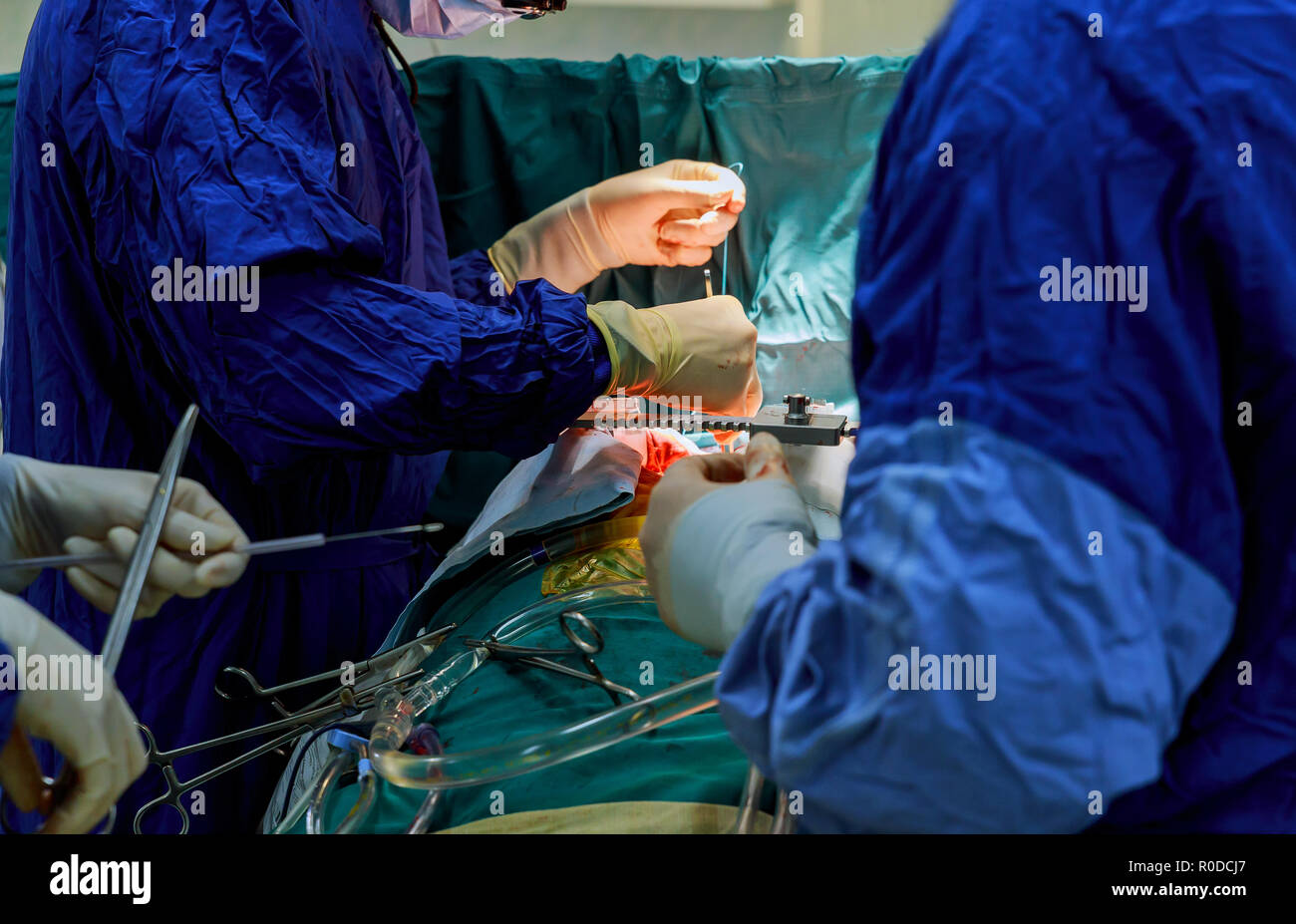 Instrument de chirurgie chirurgien pendant l'opération à coeur ouvert Banque D'Images