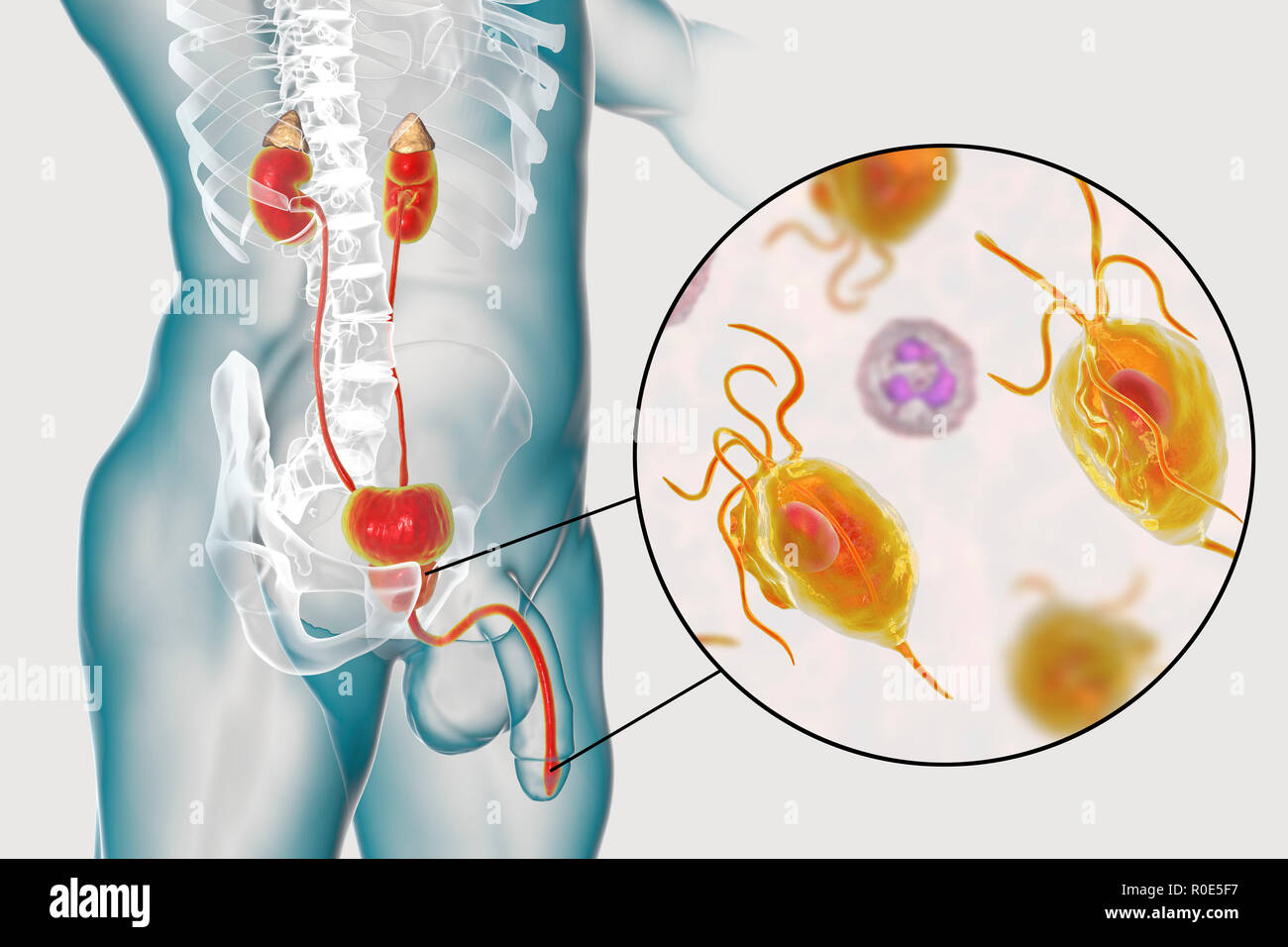 La trichomonase. Illustration de l'ordinateur de l'homme système urinaire  et les micro-organismes parasitaires Trichomonas vaginalis, qui est l'agent  causal de la trichomonase. La trichomonase est une cause commune de  l'urétrite et la