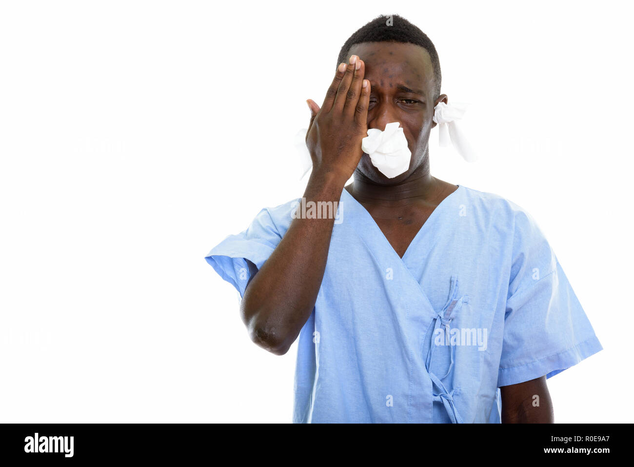Studio shot of young black African man patient ayant un mal de tête Banque D'Images
