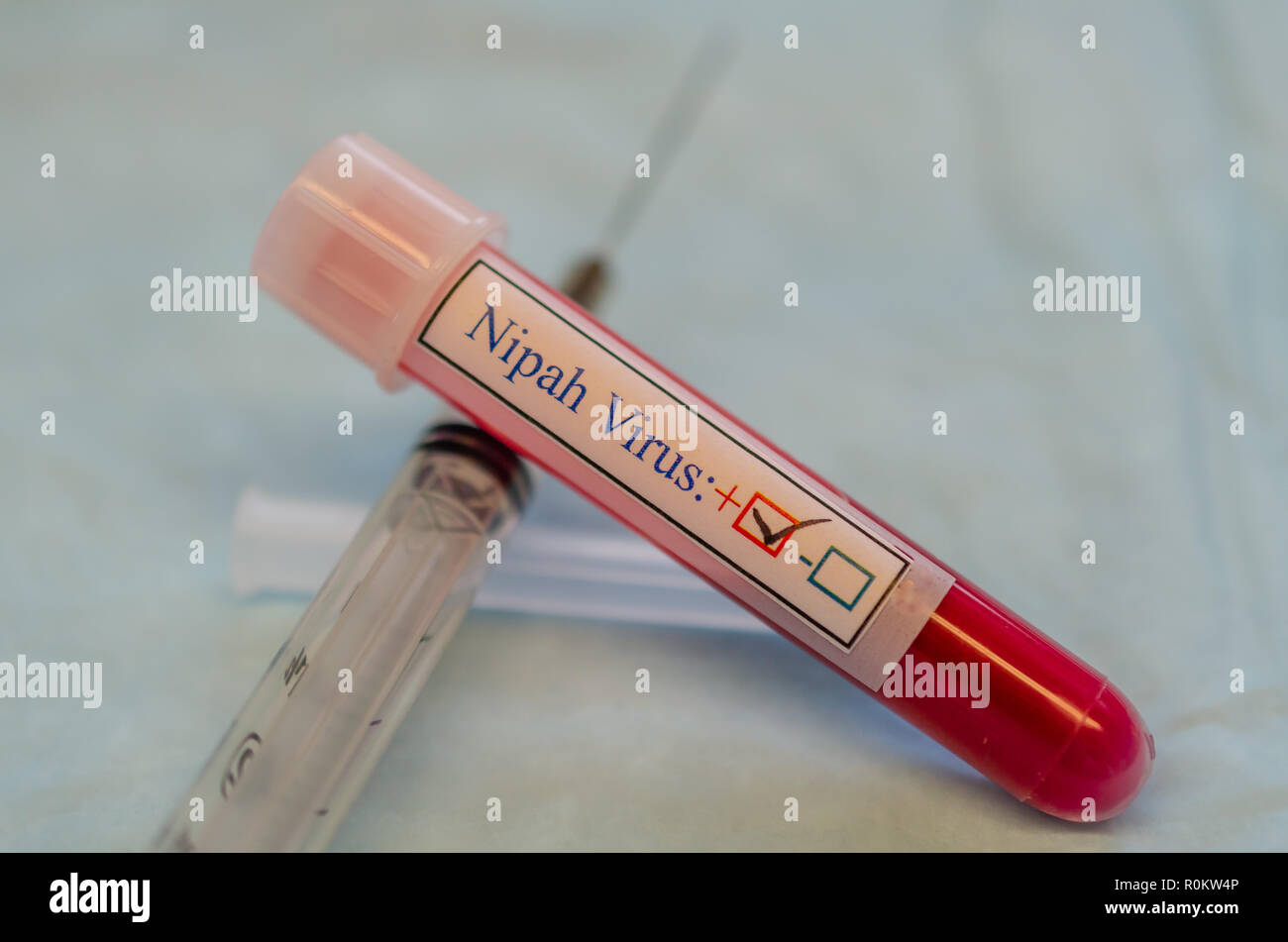 Échantillon de sang positive du virus Nipah Banque D'Images