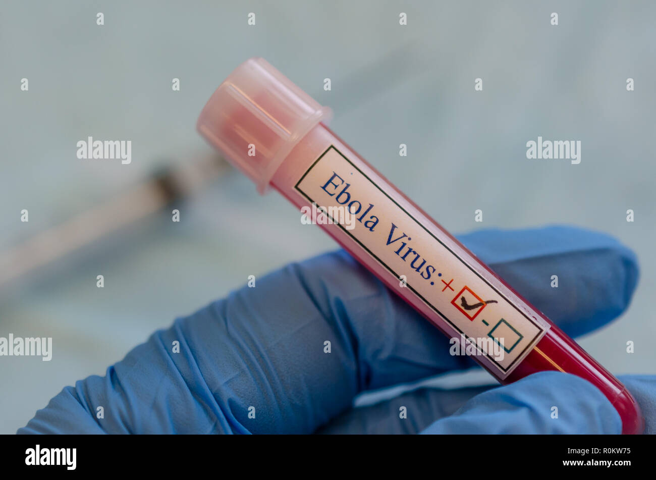 Échantillon de sang positive du virus Ebola Banque D'Images