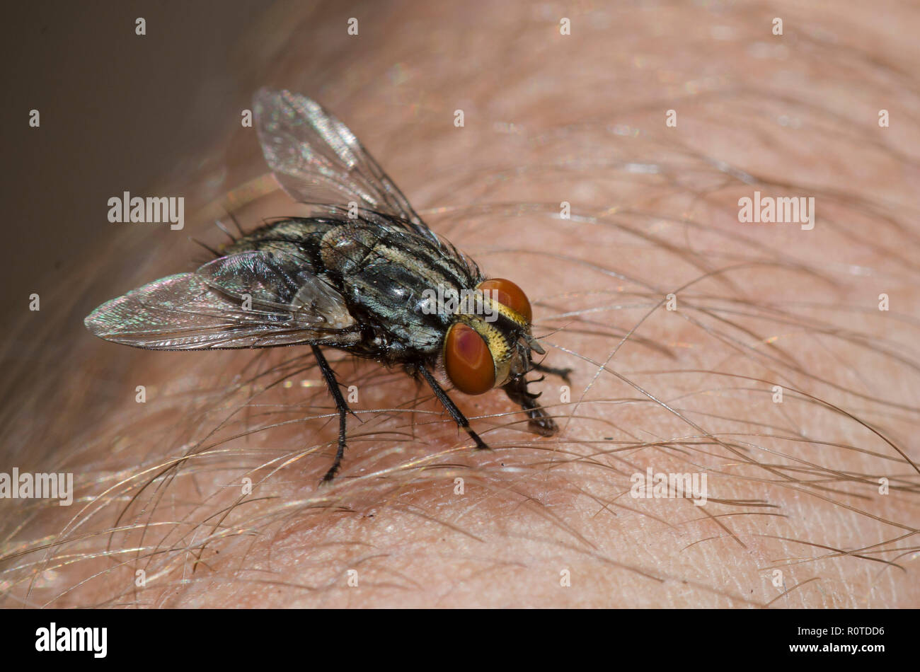 Tachinaire, sous-famille des Exoristinae, sonder la peau humaine Banque D'Images