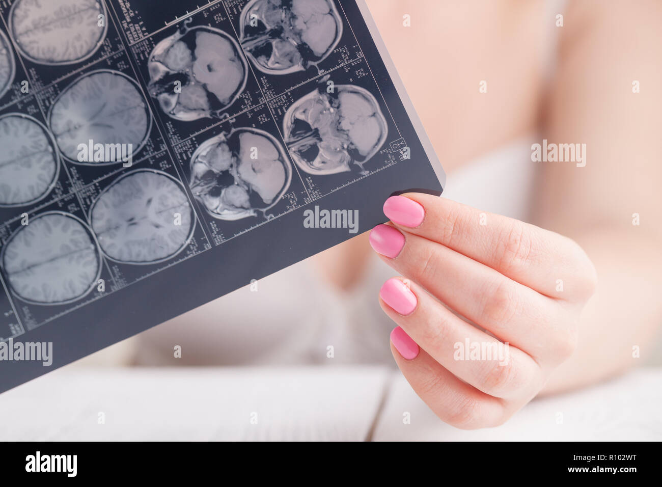 Woman hand holding cerveau IRM film à voir pour le diagnostic et le rapport. Concept médical Banque D'Images