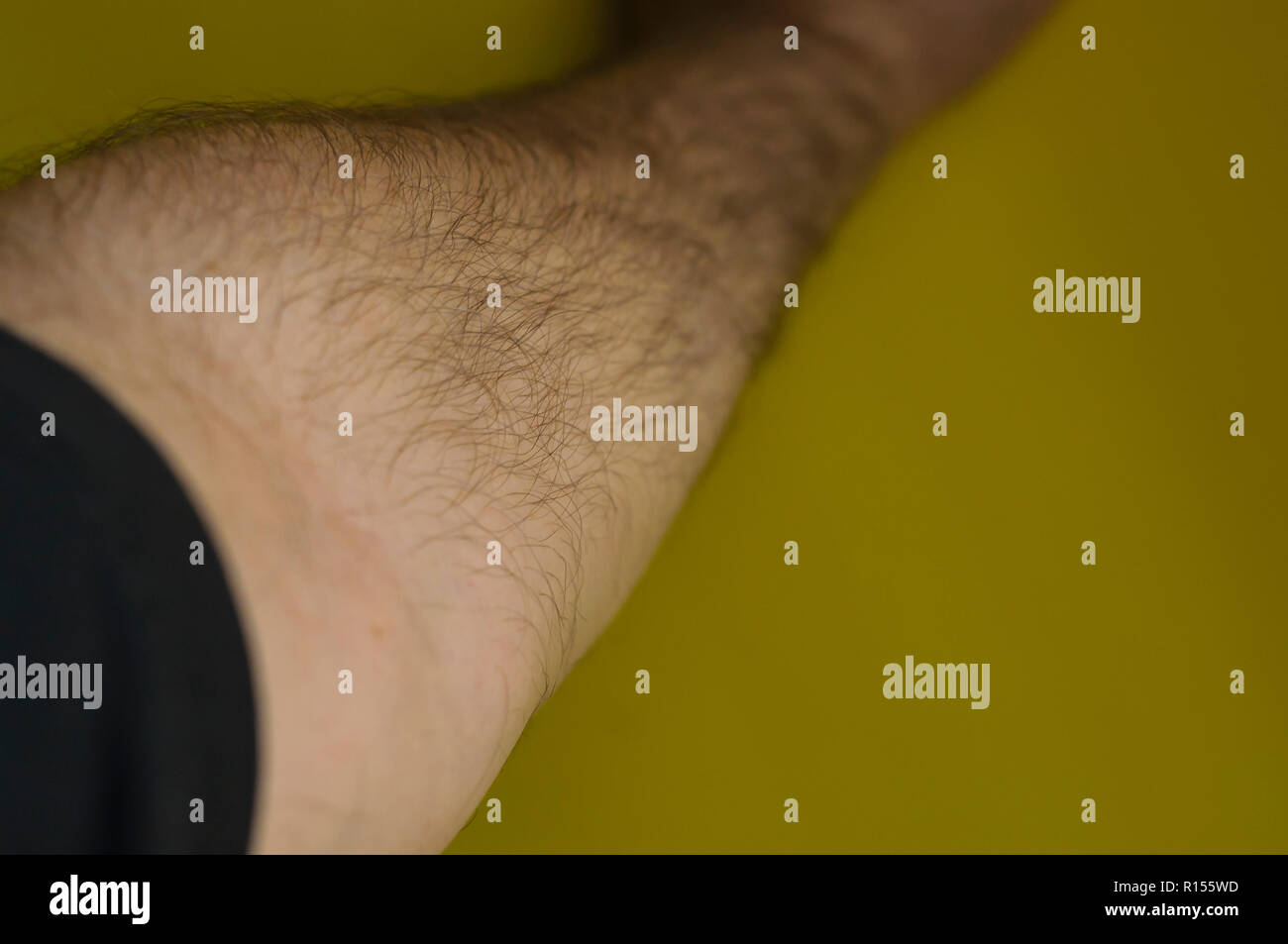 Ponction à bras Banque D'Images