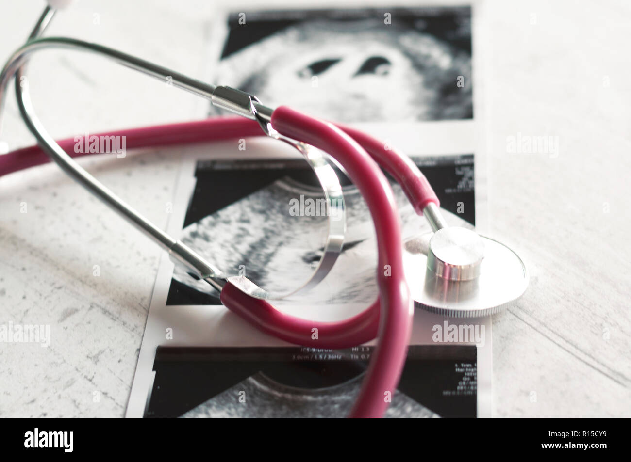 Aperçu des twins sur l'échographie au stade d'embryons. Échographie de grossesse multiple dans la quatrième semaine. Selective focus Banque D'Images